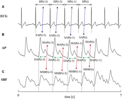 Peripheral Resistance Baroreflex During Incremental Bicycle Ergometer Exercise: Characterization and Correlation With Cardiac Baroreflex